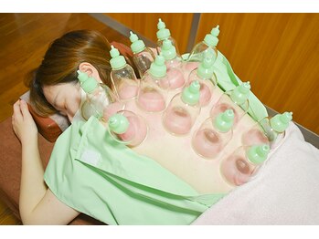 かんだ接骨院/カッピング