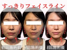 小顔になるの諦めてませんか？Minoruの小顔矯正整体にお任せ！