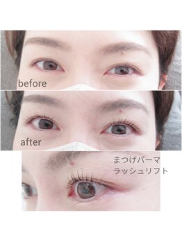 アイシック 勝どき(eyechic)/まつげパーマ 勝どき月島晴海
