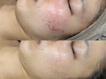 ビープラス(Biplus)