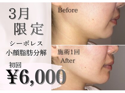 ミア(miiia)の写真