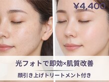 フルーブラン(Frubran)/フォトで一気に引き上げ肌質改善
