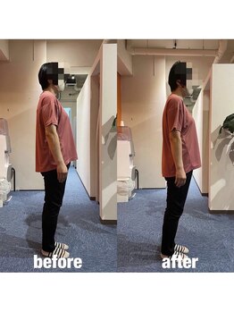 カワル整体 上通り院/頭痛と肩こりでお困りのお客様】