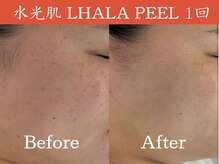 一期一会 恵比寿店(ichigo ichie)/ララピールbefore after 