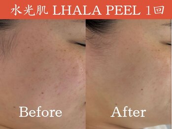 一期一会 恵比寿店(ichigo ichie)/ララピールbefore after