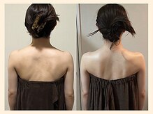 ラフリー 神戸三宮院(RUFFREE)/背中美人に大変化【神戸三宮】