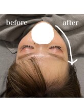 ベール(BEHL)/ドライヘッドスパ30分後の変化！