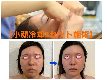 富士宮小顔整体院の写真