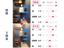 よつ葉接骨院の雰囲気（体の姿勢を数値で可視化し、不調の原因にしっかりアプローチ！）