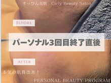 シエリー 原宿本店(Ciely)の雰囲気（本気の肌質改善プログラム［ニキビ/毛穴/渋谷/原宿］）