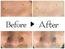 ルース(LUZ)/フェイシャルケアでトーンアップ