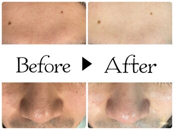 ルース(LUZ)/フェイシャルケアでトーンアップ