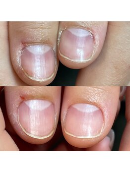 キラリネイル(KIRARINAIL)/お客さまの変化