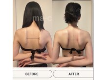 マシェリ(ma-che'rie)/3D肩甲骨剥がし