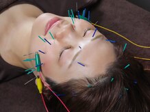  【美容鍼×ヘッドスパ×整体】KALON