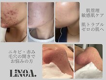 リノアドット(LiNOA.)