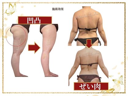 アライア(Alaia)の写真