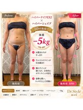 ドクタースタイル(Dr.style)/10回目/三ヶ月♪-5kg(マエナス)