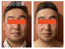 ロイヤリティ(ROYALTY)/ご紹介者様は男性もOK♪ 