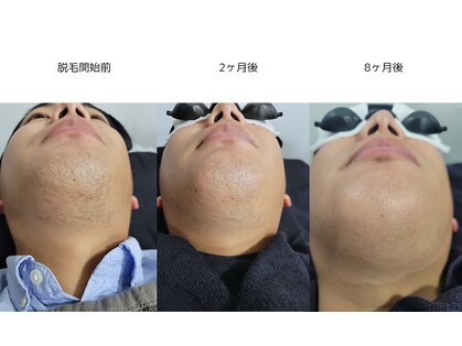 シーケスト(seekest.)の写真