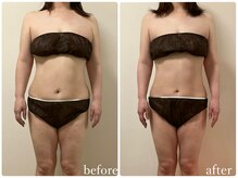 リリィブラン(Lily branc)/【痩身】上半身/お腹+ウエスト