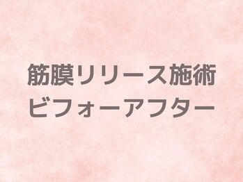 シェルサロン(Shell Salon)/ビフォーアフター