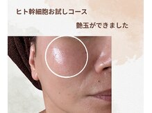 ココビ 駅家店(COCO美)/1回でも効果がわかる