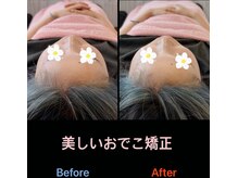 美容矯正サロン レレポノ(LELEPONO)/