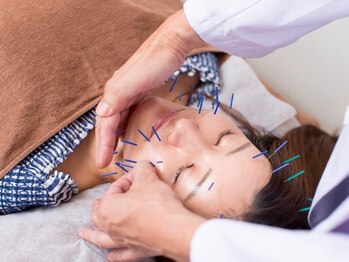 こじま 富雄団地接骨院の写真/パソコン・スマホ・目の疲れにスッキリ美容鍼◎視界クリアで爽快リフレッシュ♪