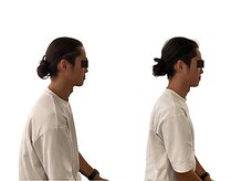 整体と美容鍼 無名/Before＆After【心斎橋/南船場】