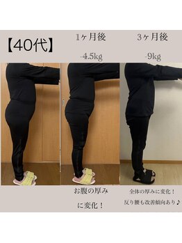 ヨサパーク ノワール(YOSA PARK Noir)/3ヶ月before/after 1