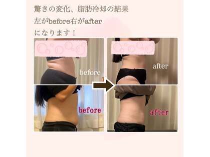 シャイン(SHINE)の写真