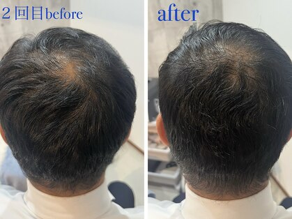 マイントゥー(mine too)の写真