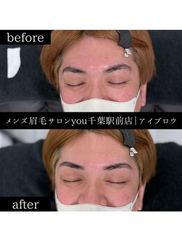 ユー 千葉駅前店(you)/ビフォ－アフター写真