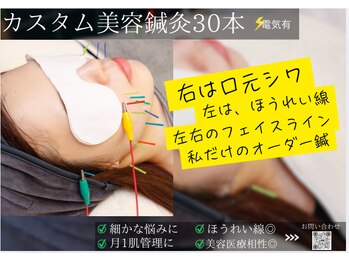 ミエリア美容鍼灸院(mielia美容鍼灸院)/カスタムリフトにプラスのパワー