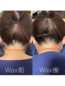 カナウ(KANAU)/うなじワックス（30代女性）