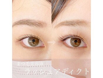 ルイール 光の森(Luire)/熊本まつげパーマ/えくぱ