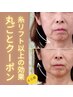 【糸リフト以上の効果！】50代60代早く変わりたい方専用★丸ごと改善クーポン