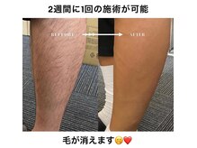 メルディアナ(MAR DIANA)の雰囲気(あなたの抱える頑固な毛の悩みも圧倒的な効果で解決!)