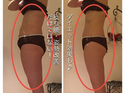 リエンシン(Riensin)の写真