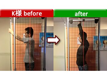 アセルカイロプラクティック/肩痛みケア　阿佐ヶ谷/整体