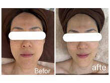 ラヴィエールフローラ(Laviere Flora)/フェイシャル