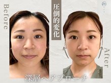 ハリドコロケン(KEN)
