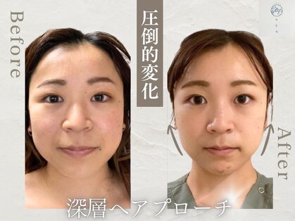 ハリドコロケン(KEN)の写真
