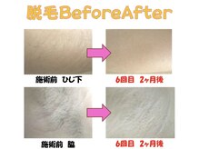 ミセル(MISEL2nd)の雰囲気（脱毛でつるすべ肌！ムダ毛を整え、清潔感あるなめらかな素肌へ♪）