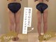 ヴィマ 北堀江(Vima)の写真/【下半身特化】歴19年の凄腕技術×創業44年本格機械で太もも・ふくらはぎを徹底ケア【四ツ橋/西大橋/痩身】