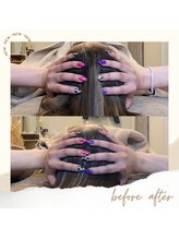 ベルフィーヌ(belfine)/内側にアプローチ