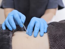 えりこ鍼灸治療室/お腹周りへも