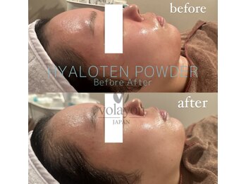 ペイジ(peige)/【peige】症例写真