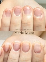 マリーロール 淀屋橋本店(Marie Laure)/自爪育成/深爪矯正/ネイルケア